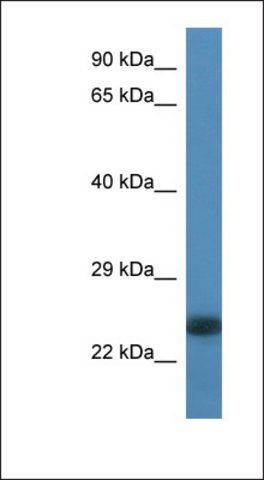 Anti-LOC100359980 antibody produced in rabbit