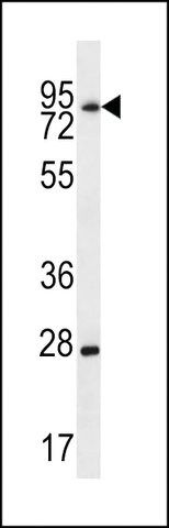 ANTI-LIMD1(C-TERMINAL) antibody produced in rabbit