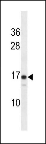 ANTI-LIM2 (C-TERM) antibody produced in rabbit