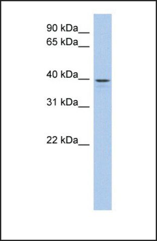 Anti-LIX1L, (N-terminal) antibody produced in rabbit