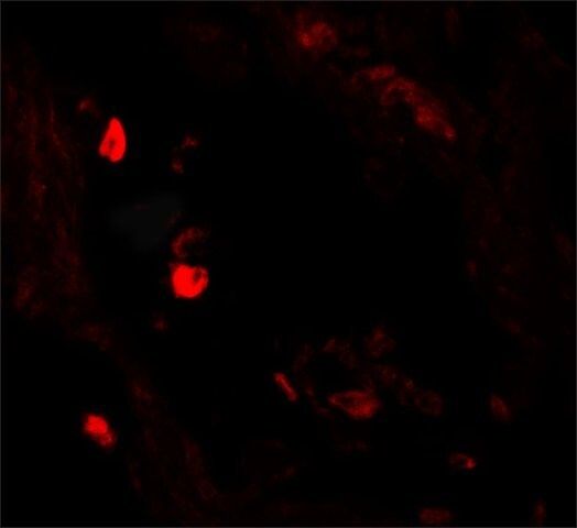 Anti-LNPEP antibody produced in rabbit