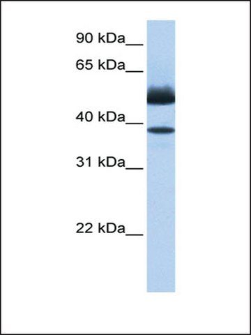 Anti-LIPJ antibody produced in rabbit