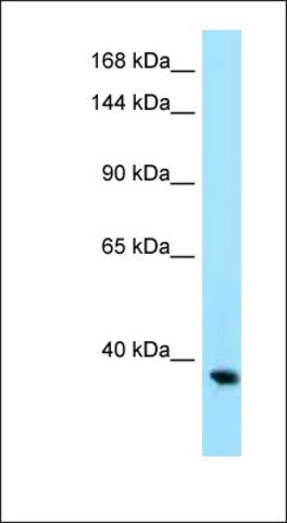 Anti-LOC100504025 antibody produced in rabbit