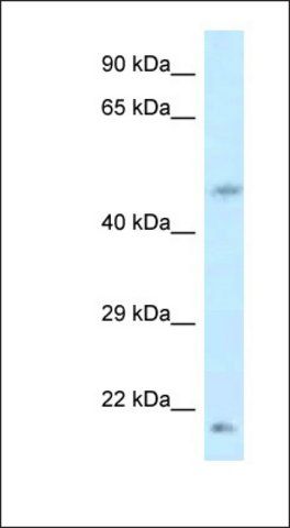 Anti-LOC100360413 antibody produced in rabbit