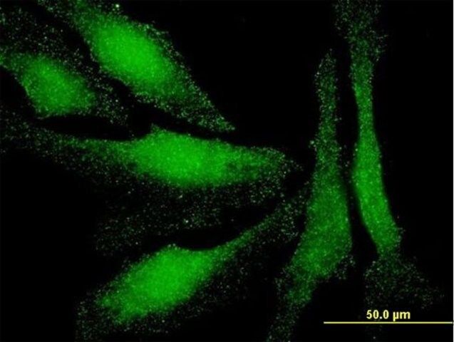 ANTI-LMO3 antibody produced in mouse