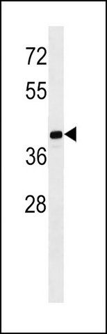 ANTI-MAGEB10 (CENTER) antibody produced in rabbit