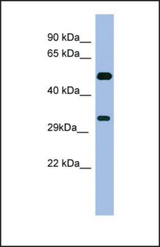 ANTI-MAGEB1 antibody produced in rabbit