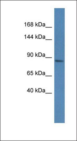 Anti-MAGEE1 antibody produced in rabbit