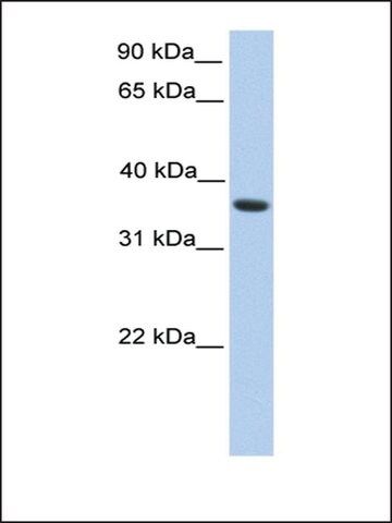 Anti-MAGEA4 antibody produced in rabbit