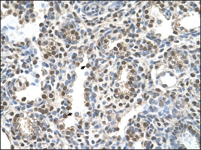 Anti-MAGEA8 antibody produced in rabbit