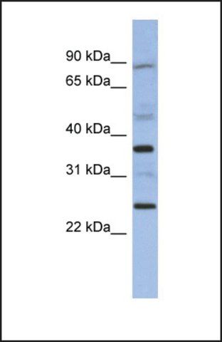 Anti-MAGEB3, (N-terminal) antibody produced in rabbit