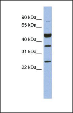 Anti-MAGEB3, (N-terminal) antibody produced in rabbit