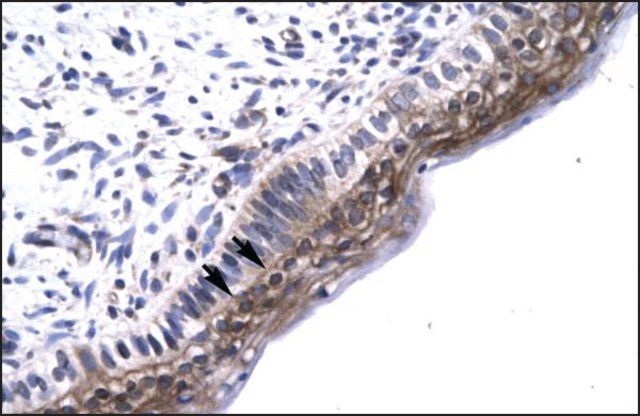 Anti-MAP3K7IP2 antibody produced in rabbit