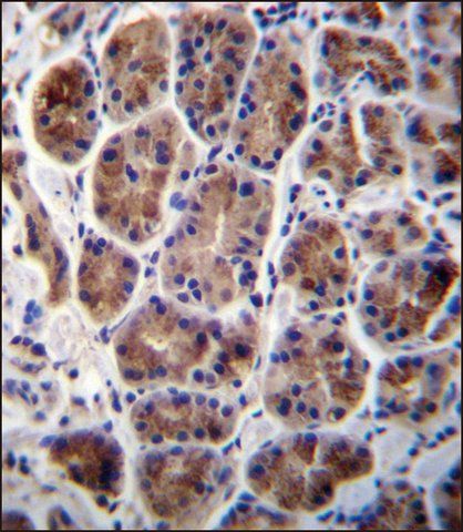 ANTI-MAN2A2 (CENTER) antibody produced in rabbit