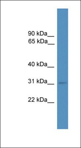 Anti-MBD3 antibody produced in rabbit