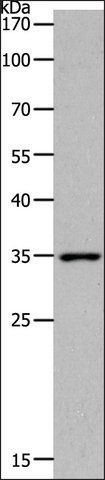 Anti-MC2R antibody produced in rabbit