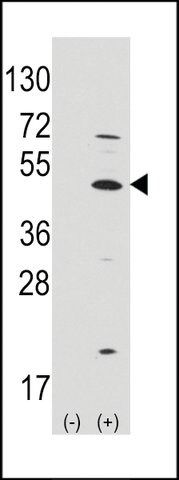 ANTI-MATH1/HATH1/ATOH1(C-TERMINAL) antibody produced in rabbit