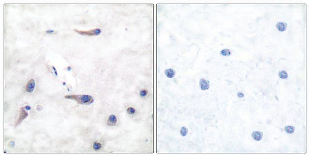 Anti-MARCKS antibody produced in rabbit