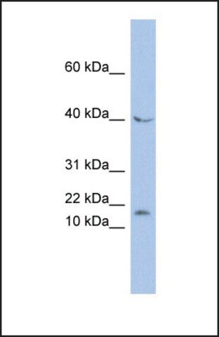 Anti-MAX, (N-terminal) antibody produced in rabbit