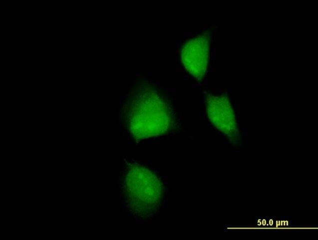 ANTI-MAPKAPK2 antibody produced in mouse