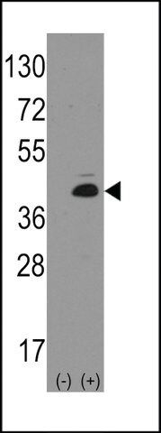 ANTI-MATH1/HATH1/ATOH1(N-TERMINAL) antibody produced in rabbit