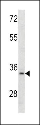 ANTI-MCA1(C-TERMINAL) antibody produced in rabbit