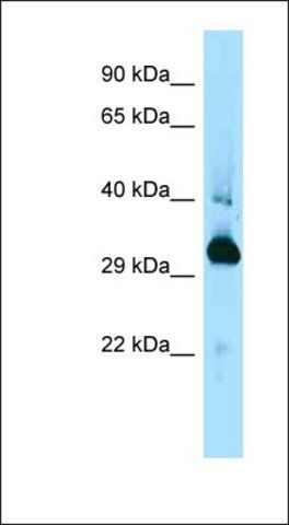 Anti-MAPRE1 antibody produced in rabbit