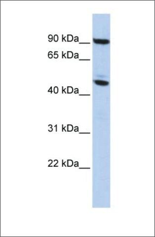 Anti-MeCP2 antibody produced in rabbit