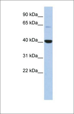 Anti-MBD1 antibody produced in rabbit