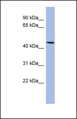 Anti-MATN3, (N-terminal) antibody produced in rabbit