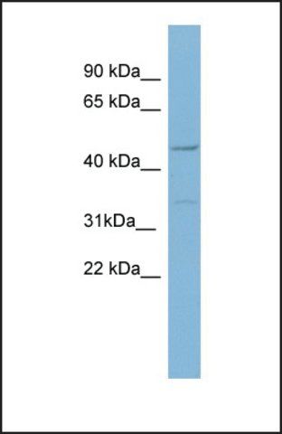 Anti-MATN1 antibody produced in rabbit