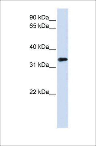 Anti-MBD3 antibody produced in rabbit