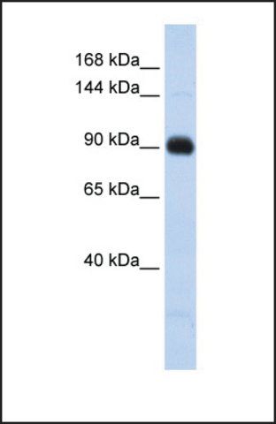 Anti-MATN2 antibody produced in rabbit