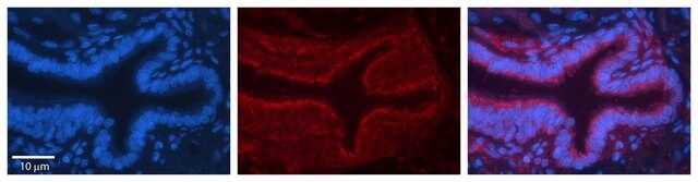 Anti-ME1 antibody produced in rabbit