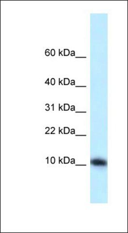 Anti-MED21 antibody produced in rabbit