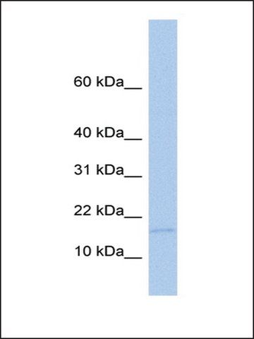 Anti-MED21 antibody produced in rabbit