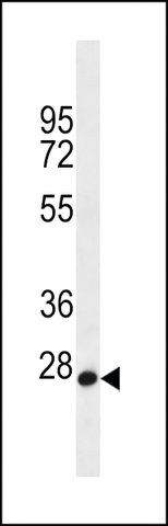 ANTI-MED22(N-TERMINAL) antibody produced in rabbit