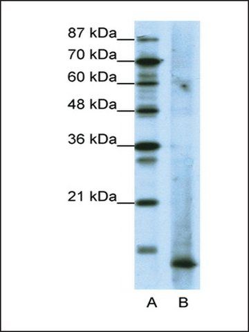 Anti-MDS1 antibody produced in rabbit