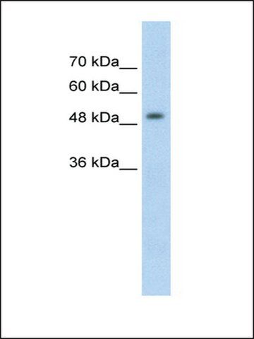 Anti-MeCP2 antibody produced in rabbit