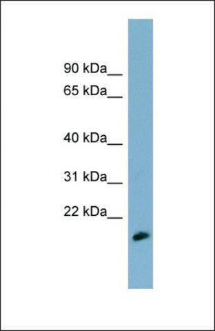 Anti-MDP-1, (N-terminal) antibody produced in rabbit