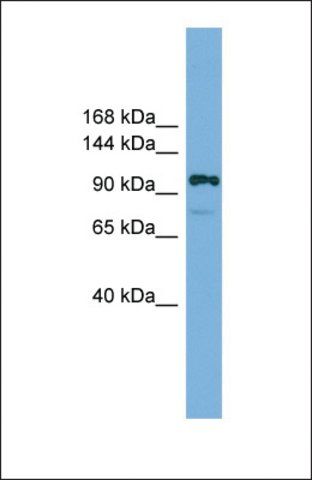 Anti-HIRA antibody produced in rabbit