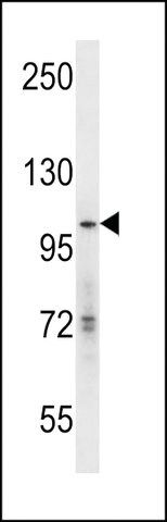 ANTI-HGCN5(C-TERMINAL) antibody produced in rabbit