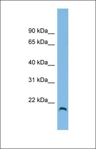 Anti-HFE2, (N-terminal) antibody produced in rabbit