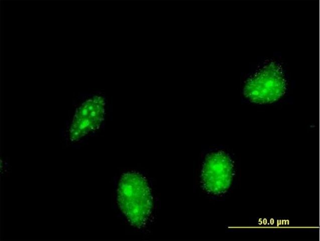 ANTI-HIC1 antibody produced in mouse