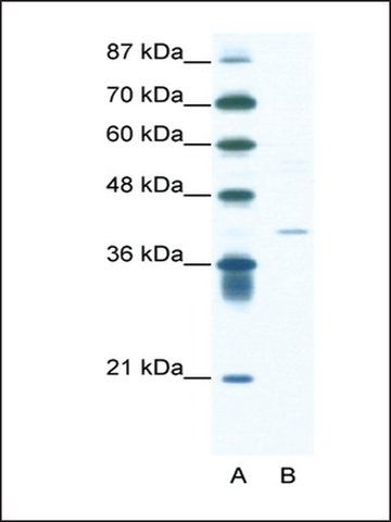 Anti-HIF1AN (AB3) antibody produced in rabbit