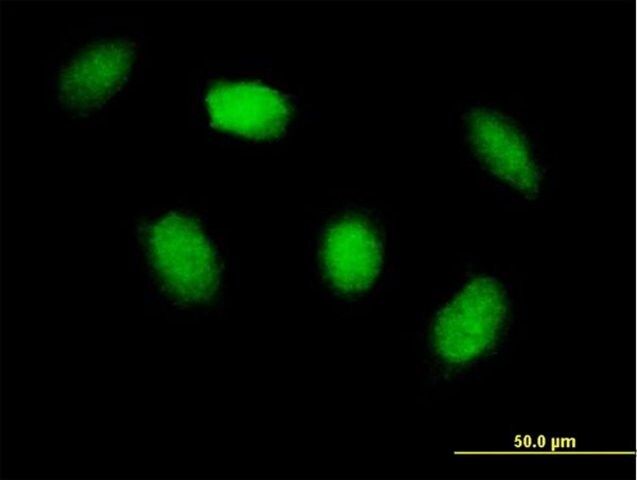 Anti-HIPK4 antibody produced in mouse