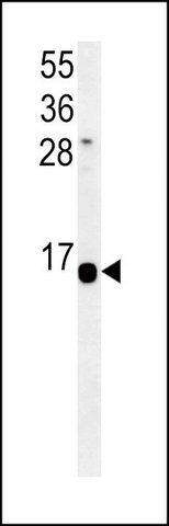 ANTI-HIST1H2AK (N-TERM) antibody produced in rabbit