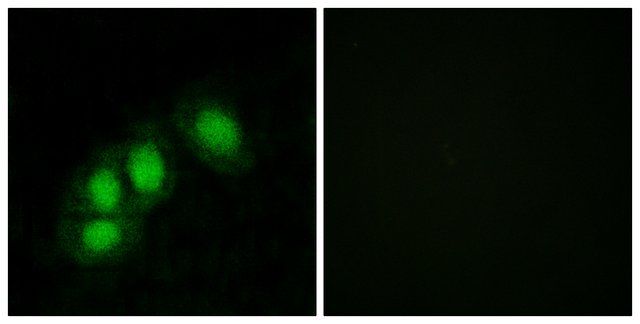 Anti-HINT1 antibody produced in rabbit