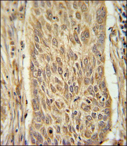 ANTI-INMT (CENTER) antibody produced in rabbit