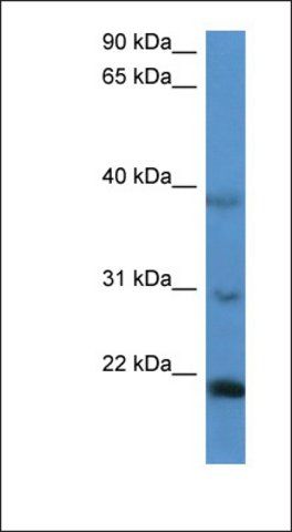 Anti-IMMP2L antibody produced in rabbit